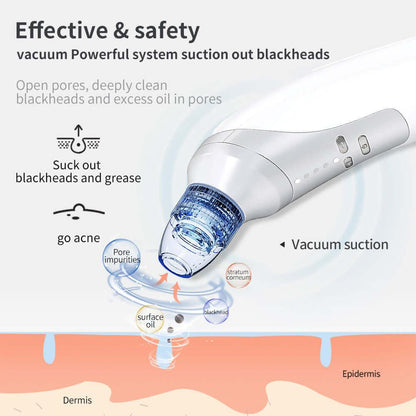 electric blackhead remover Suction Instrument, Electric