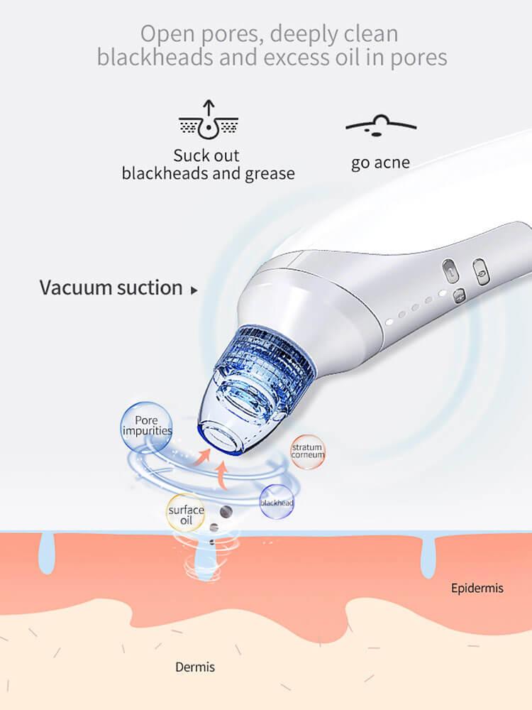 electric blackhead remover Suction Instrument, Electric